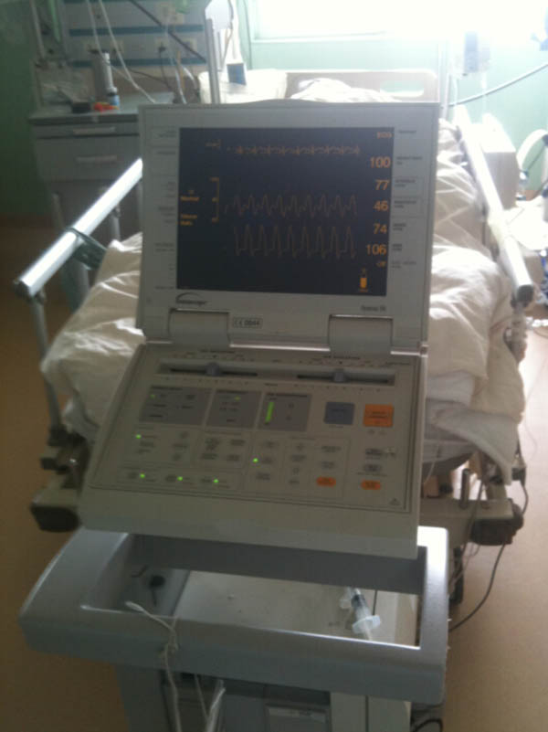 主動脈球囊反搏